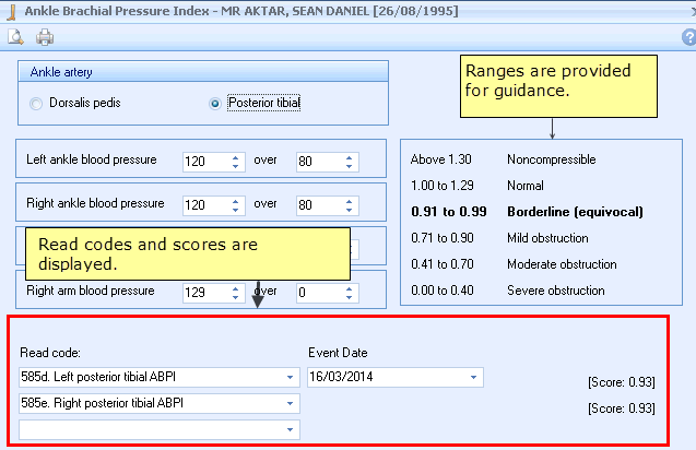 ABPI Calculator